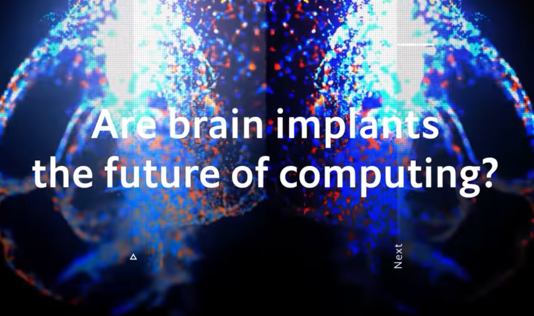 Are Brain Implants the Future of Computing